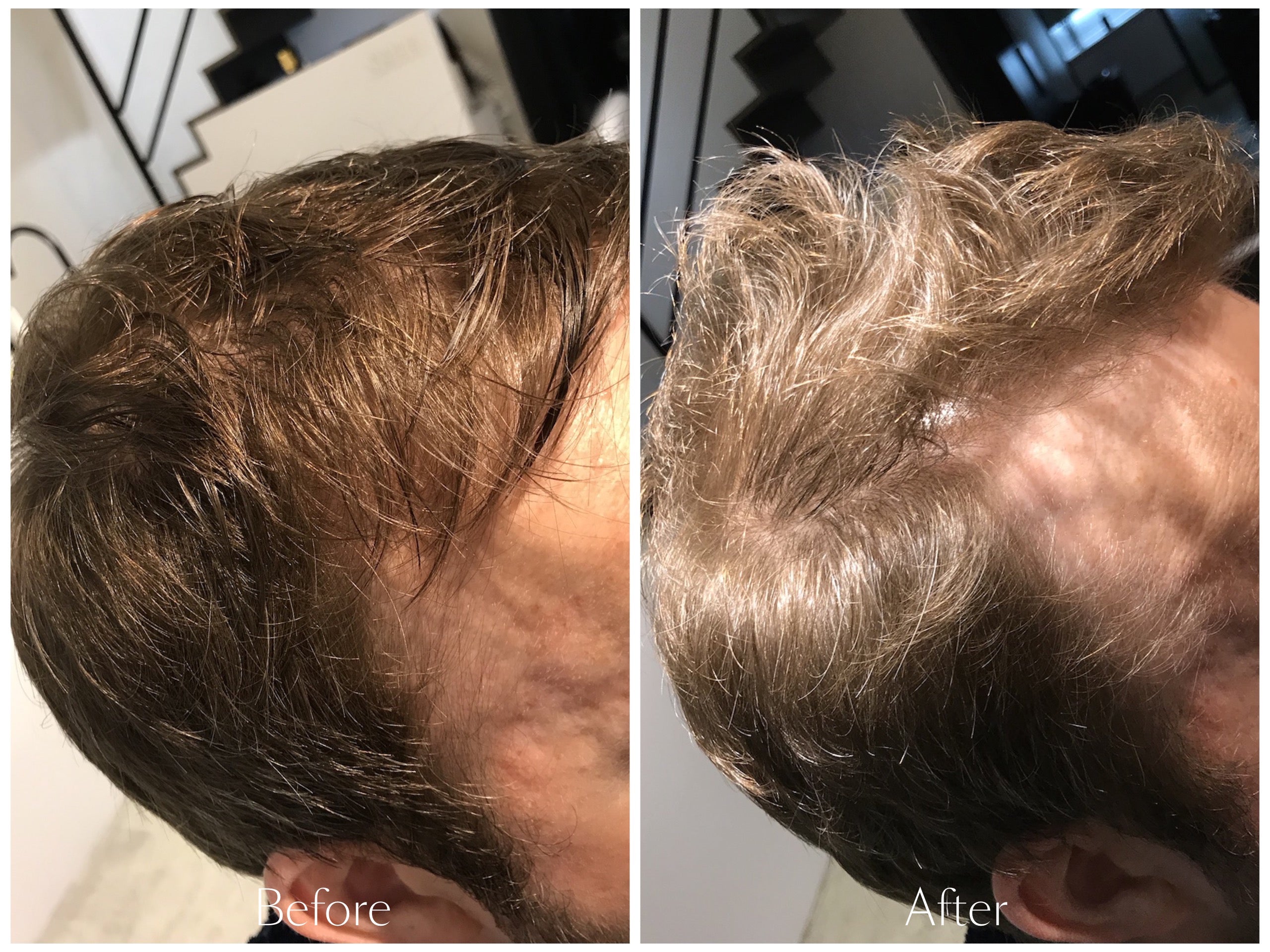 OMG Scalp Treatment (230g)